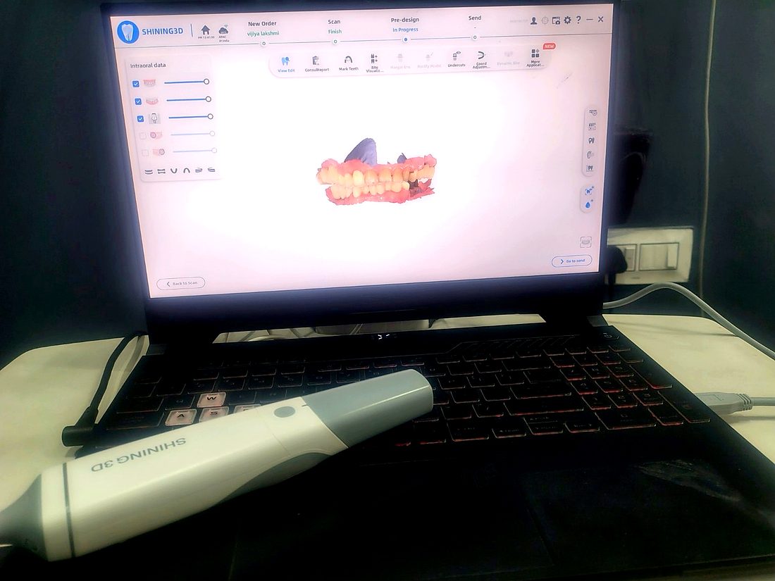 Shining 3D intraoral scanner